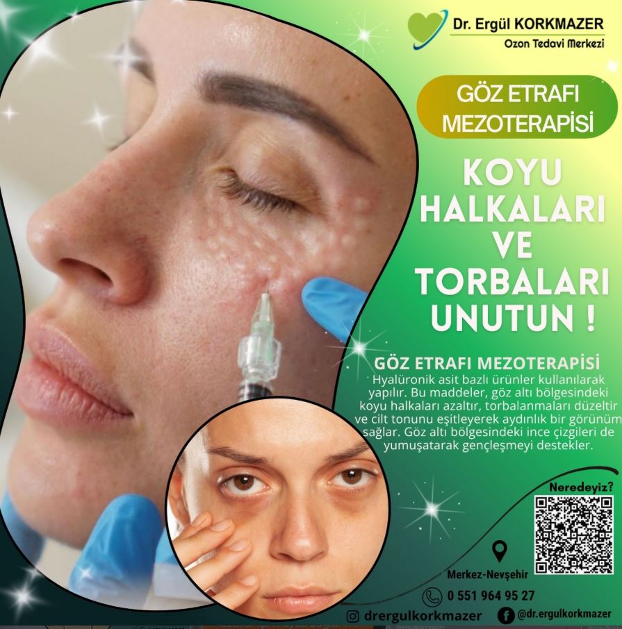 GÖZ ETRAFI MEZOTERAPİSİ