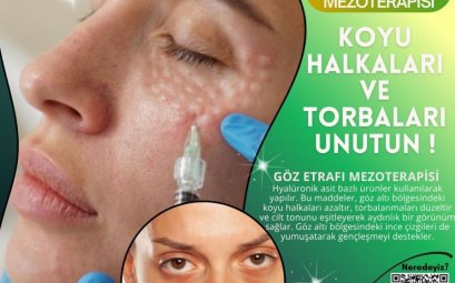 GÖZ ETRAFI MEZOTERAPİSİ